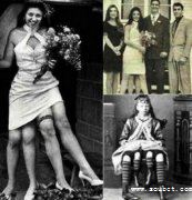 世界上腿最多的女人，4條腿照樣結(jié)婚生子