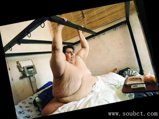 世界上最胖的男人成為減重最多的人