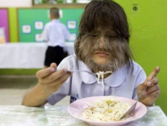 狼孩是什么意思，狼孩沒有意識說明什么