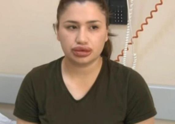 香腸嘴好看嗎，香腸嘴和厚嘴唇的區(qū)別