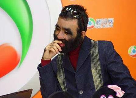 于震寰為什么不脫毛,于震寰有多少身價