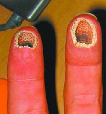 空手指因為什么引起,空手指為什么嚇人