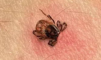 蜱蟲在什么地方生活