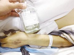 雞虱子爬人身上怎么辦,陽(yáng)光下暴曬