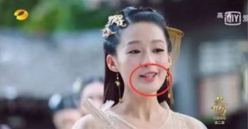 竇驍的牙是真的嗎