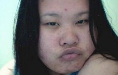 臉上有蒼蠅屎怎么去除