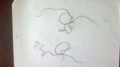 鐵線蟲會在人體繁殖嗎