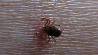 蜱蟲是怎么形成的