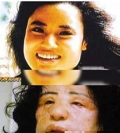 聶遠(yuǎn)削骨太多了嗎