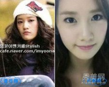 林允兒眼睛是雙眼皮嗎