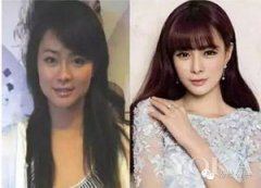 沈夢辰為什么被黑