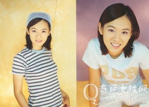 孫藝珍整容了嗎