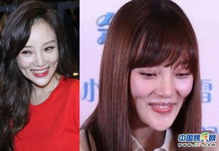 劉雨欣下巴怎么回事