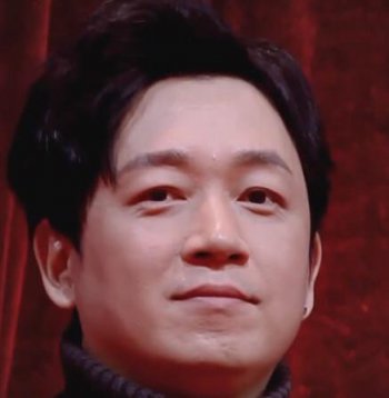 潘粵明的臉怎么了