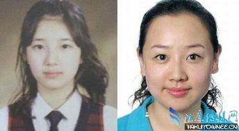 裴秀智是什么臉型