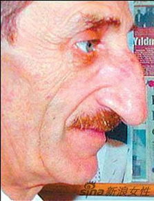 世界上最矮的人有幾厘米