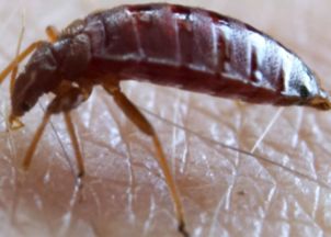 床虱怎么徹底消滅