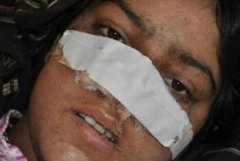 割鼻子的刑罰叫什么