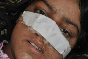 割鼻子的刑罰叫什么