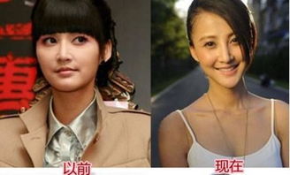 張歆藝怎么越來越丑了