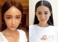 張歆藝怎么越來越丑了