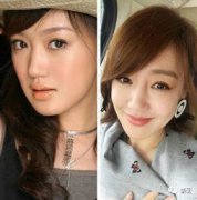 薛佳凝的臉是怎么回事