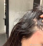 潘南奎為什么叫花蛇