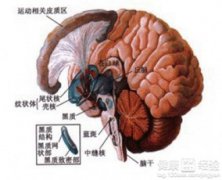 腦梗塞和腦梗死有什么不同