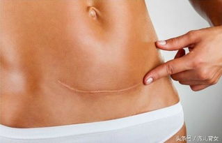 舍曲林損傷記憶力嗎