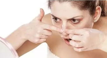 超大黑頭怎么形成的