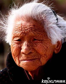 震驚黑龍江：哈爾濱貓臉老太太事件真相大揭秘（圖片）