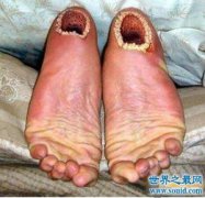 超惡心的空手指是什么，現實生活中是并不存在