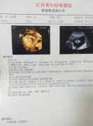 四維彩超字母代表什么