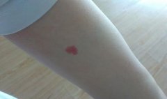 左胳膊有胎記代表什么