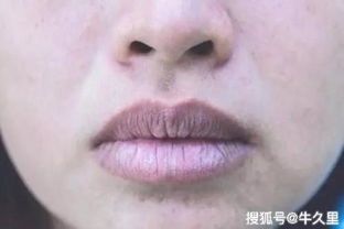 額頭發黑是什么征兆