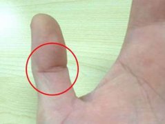 大拇指有佛眼的女人什么命，有佛眼的人都有福