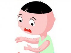 被跳蚤咬了怎么辦，可以涂抹風油精