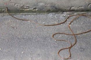 線蟲會寄生在人體嗎,會寄生在人的身體里變成鐵線蟲病