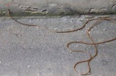 線蟲會寄生在人體嗎,會寄生在人的身體里變成鐵線蟲病