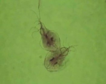 蟑螂會寄生在人身上嗎，氧不足時蟑螂不能在里面生存