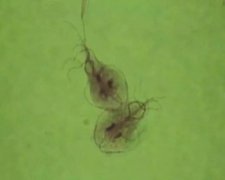 蟑螂會寄生在人身上嗎，氧不足時蟑螂不能在里面生存