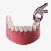 拔完智齒多久可以正常吃飯,7天左右可以正常進食