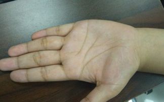 女人克夫的15種面相，眼睛凸露、嗓子粗、喉結和牙齒突露等