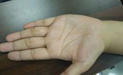 女人克夫的15種面相，眼睛凸露、嗓子粗、喉結(jié)和牙齒突露等