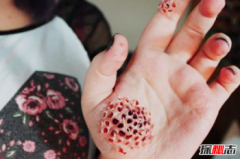 最嚴重的恐懼癥，世界上10種奇怪的恐懼癥