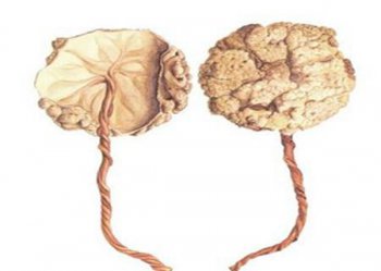 胎盤(pán)不能給別人吃嗎，人胎盤(pán)到底能不能吃