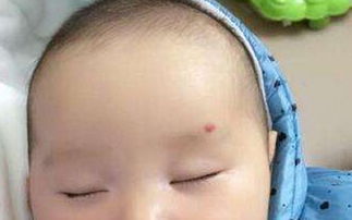 神仙轉(zhuǎn)世胎記的位置，額頭、手臂、前胸、腹部和肚臍周圍