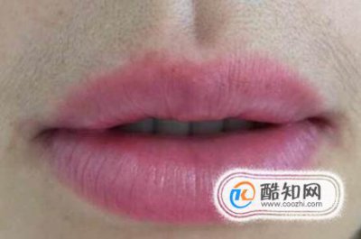 女生的小胡子怎么去掉，歐陽娜娜如何去唇毛