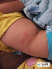 怎么徹底消滅家里的跳蚤，農(nóng)村滅跳蚤最有效的方法