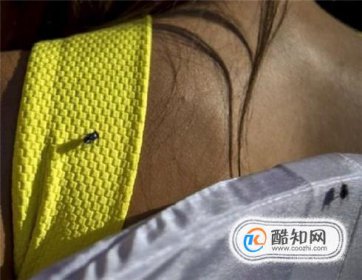 衣服上蒼蠅屎怎么去除，防止蒼蠅在衣服上拉屎